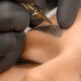 Détatouage laser des sourcils : risque de changement de couleur