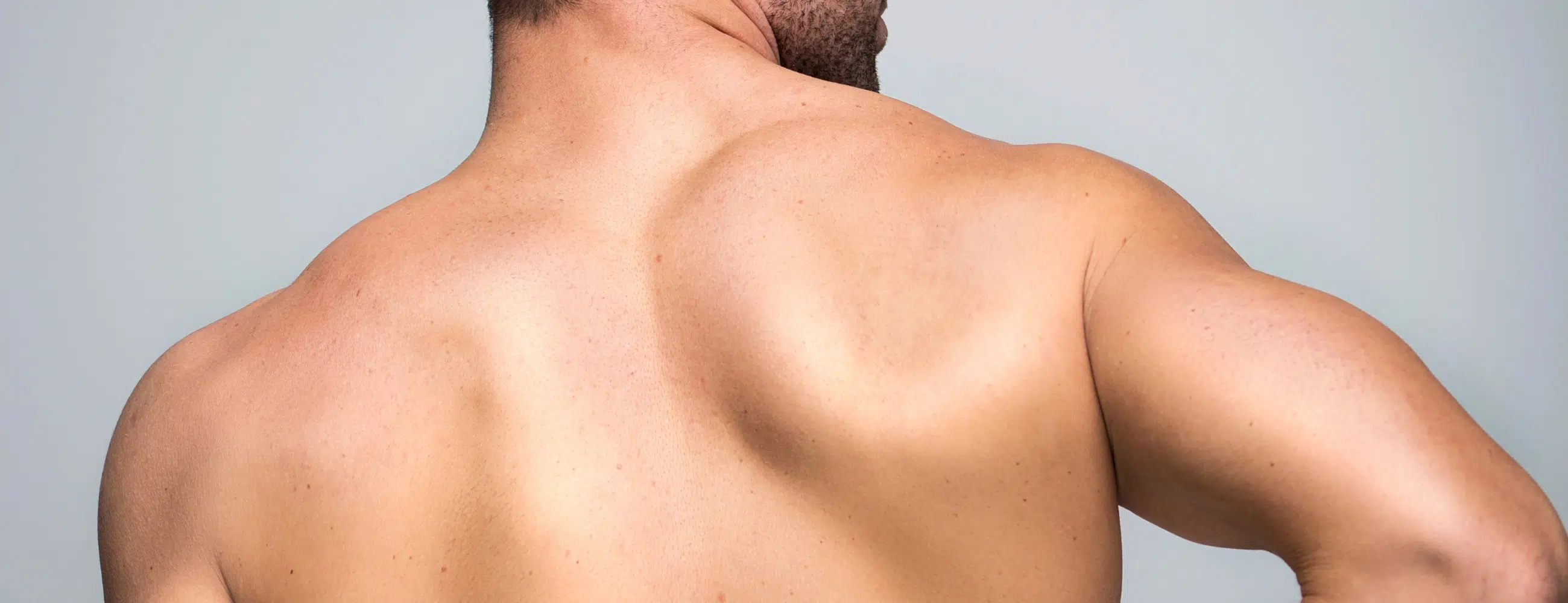 Epilation laser du dos chez l’homme