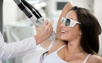 Épilation laser médicale