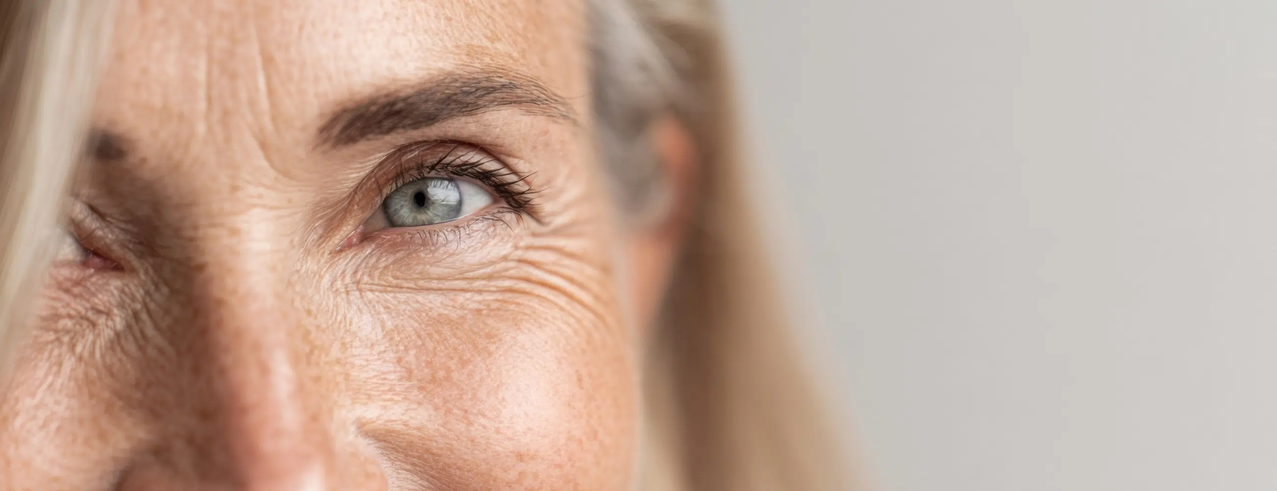 Vieillissement cutané