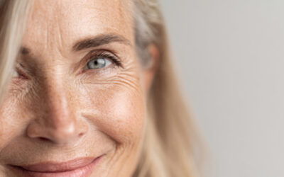 Vieillissement cutané