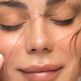 Épilation électrolyse du visage : dans quels cas cette technique peut-elle être utile?